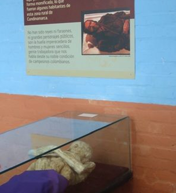 Người dân địa phương cũng đưa ra một số giải thích về hiện tượng này. Có người cho rằng đó là do độ tinh khiết của nguồn nước trong làng và thức ăn của họ không có các chất phụ gia hóa học.