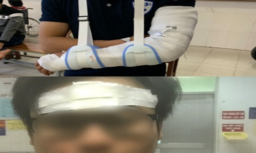 Mâu thuẫn trong nhà hàng ẩm thực 915, khách bị đánh đến tàn phế Mau thuan trong nha hang am thuc 915, khach bi danh den tan phe