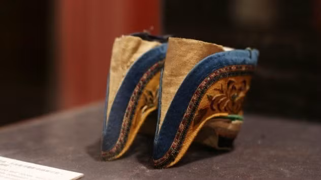 Một số phụ nữ có chân bị hoại tử, thậm chí là tử vong do thực hiện tục bó chân vô cùng đau đớn.