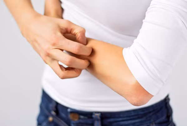 Gây kích ứng, viêm nang lông. Quần jean bó sát, chật cứng mặc nhiều dễ gây tắc nghẽn lỗ chân lông. Theo thời gian, người diện có thể đối diện nguy cơ viêm nang lông, mụn nhọt, mẩn ngứa. Mặt khác, thành phần formaldehyde được sử dụng trong quá trình sản xuất vải jean, giúp tạo độ láng mịn cho lớp vải jean cũng làm tăng khả năng gây kích ứng da.