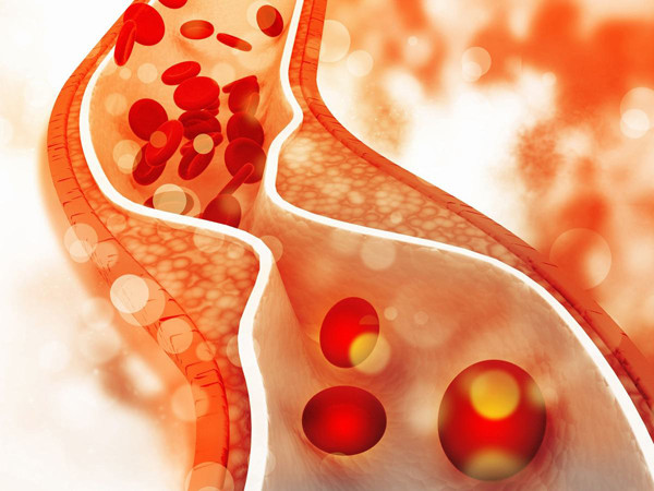 Ngoài các vấn đề về tim mạch, người bị lạnh tay chân còn có thể bị tắc nghẽn mạch máu. Triệu chứng ban đầu là tay chân lạnh, tê nhức. Nếu không điều trị dễ dẫn tới mất ngủ, các bệnh toàn thân. Đặc biệt, bệnh nhân tiểu đường thường gặp các triệu chứng như mạch máu bị tắc nghẽn, tay chân lạnh là một trong những biến chứng cần cảnh giác cao độ.