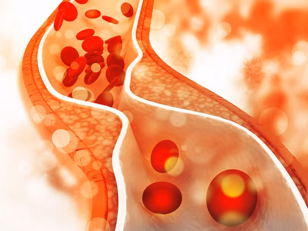 Ngoài các vấn đề về tim mạch, người bị lạnh tay chân còn có thể bị tắc nghẽn mạch máu. Triệu chứng ban đầu là tay chân lạnh, tê nhức. Nếu không điều trị dễ dẫn tới mất ngủ, các bệnh toàn thân. Đặc biệt, bệnh nhân tiểu đường thường gặp các triệu chứng như mạch máu bị tắc nghẽn, tay chân lạnh là một trong những biến chứng cần cảnh giác cao độ.