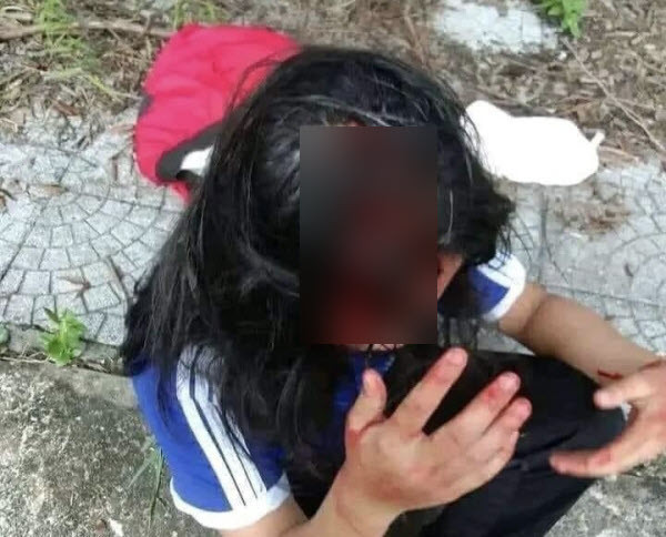  Không mua nước uống dùm bạn, 1 nữ sinh lớp 8 bị đánh toác đầu: Ngày 17/9/2022, Công an xã Lộc Thủy cho biết, qua xác minh vụ nữ sinh bị đánh toác đầu, người đánh là H.T.L.A và người bị đánh là T.T.H.L, đều học lớp 8/4 Trường THCS Lộc Thủy. Theo báo cáo của Trường THCS Lộc Thủy, chiều 14/9, lớp 8/4 có học 2 tiết thể dục từ 15h35 đến 17h15, hai em H.L và L.A đi học sớm, do H.L không mua nước dùm L.A nên dẫn đến mâu thuẫn, đánh nhau. L.A đã dùng tay, gậy đánh tới tấp vào người và đầu H.L. Trong khi L.A đánh em H.L thì có một số bạn nữ khác đi tìm gậy gần đó đưa cho L.A. Ngoài ra, một nữ sinh khác cũng xông vào giật tóc rồi đánh vào đầu khiến H.L bị chảy nhiều máu ở vùng đầu.