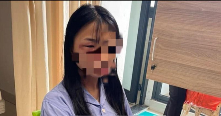  Nữ sinh lớp 8 bị đánh hội đồng ở Hà Nội: Chiều 2/4, nữ sinh G.T.C (14 tuổi, học sinh lớp 8) bị nhóm học sinh của một trường cao đẳng (đóng trên địa bàn huyện Đông Anh, TP. Hà Nội) đánh hội đồng. Vụ việc khiến C chấn thương, phù nề vùng mặt và phải nhập viện điều trị. Ngay sau vụ việc, công an huyện đã vào cuộc điều tra. Đồng thời, lãnh đạo UBND huyện Đông Anh cũng chỉ đạo phải làm rõ vụ việc.