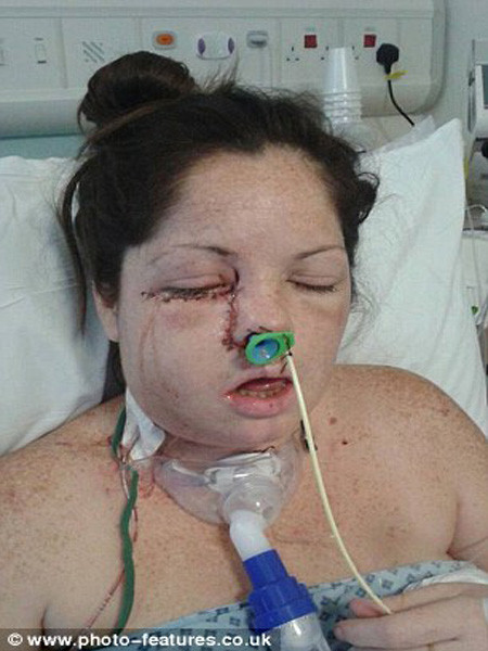 Hai tuần sau đó, cô đã trải qua ca phẫu thuật quyết định. “Tôi nhìn khuôn mặt tuyệt đẹp của 3 đứa con và tự hứa với lòng mình sẽ không để cứ điều gì xấu xảy ra với cuộc đời mình để các con tôi phải khổ”. Rất may là cuộc phẫu thuật thành công. Chuyên gia tư vấn y tế còn đùa với Lisa, hiếm ai gẫy răng mà may mắn như cô.