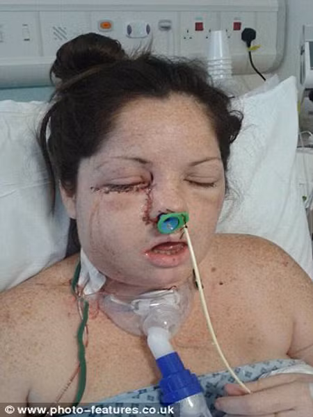 Hai tuần sau đó, cô đã trải qua ca phẫu thuật quyết định. “Tôi nhìn khuôn mặt tuyệt đẹp của 3 đứa con và tự hứa với lòng mình sẽ không để cứ điều gì xấu xảy ra với cuộc đời mình để các con tôi phải khổ”. Rất may là cuộc phẫu thuật thành công. Chuyên gia tư vấn y tế còn đùa với Lisa, hiếm ai gẫy răng mà may mắn như cô.