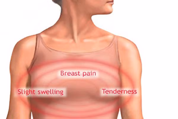Nhất là khi bạn bỗng cảm thấy ngực mình đau tức ngay cả những ngày bình thường, khi tới gần ngày kinh nguyệt thì ngực bạn càng thấy đau hơn nữa, giống như bị sưng vù lên vậy, cảm giác đau khiến bạn không dám chạm vào ngực mình thì mầm ung thư vú có thể đang bắt đầu.
