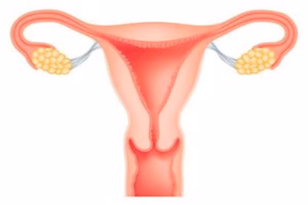 Thậm chí, các bác sĩ khuyên những phụ nữ đã trải qua mãn kinh hoặc gần mãn kinh không có tiền sử gia đình mắc bệnh vẫn có thể xem xét loại bỏ tử cung và buồng trứng. Tuy nhiên, bạn nên tìm hiểu về những lợi ích cũng như rủi ro trước khi thực hiện.