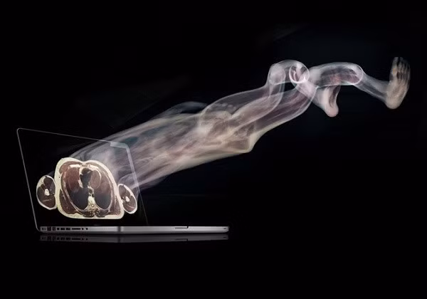 8. Các cơ quan sẽ tự tiêu hóa. Sau khi đã tê cứng, cơ thể bắt đầu thối rữa. Giai đoạn này có thể bị chậm lại bởi quá trình ướp xác, nhưng cuối cùng thì toàn bộ cũng tiêu hóa. Quá trình này bắt đầu bằng các enzyme trong tuyến tụy làm cho các cơ quan tự tiêu hóa. Vi khuẩn sẽ bám theo những emzyme này, làm cho cơ thể chuyển thành màu xanh từ bụng trở lên và lúc này vi khuẩn được tự do "đánh chén" mọi thứ.