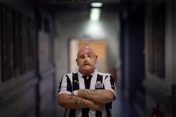 Sau những bước đầu chuẩn bị cho ca phẫu thuật loại bỏ các khối u. Ông Martin đã được bác sỹ thông báo rằng, ung thư đã lan quá nhanh và sợ rằng, việc điều trị khó mà thành công.