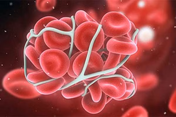 Điều quan trọng cần lưu ý là không phải tất cả các khối u thứ cấp này đều gây ung thư, có thể nó lành tính hoặc ác tính. Sự khác biệt của hai khối u này là lành tính sẽ không di căn và sẽ không tái sinh khi bị loại bỏ. Lúc này, tùy theo kích cỡ, vị trí và hình dạng mà bác sỹ sẽ có quyết định điều trị phù hợp.