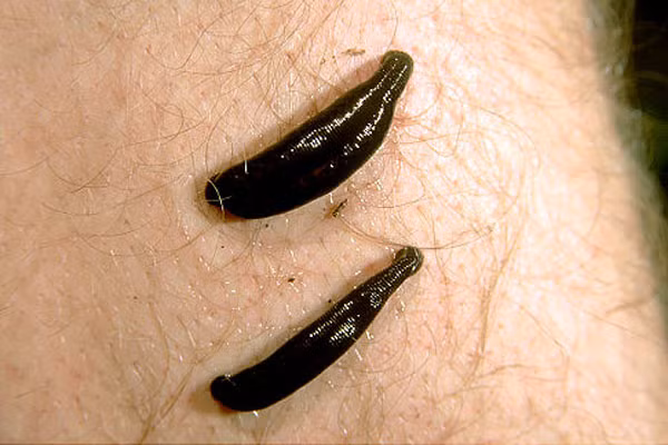  Đỉa giảm đau các khớp gối. Các nhà khoa học cho hay, đỉa có thể xoa dịu sự đau đớn ở bệnh nhân viêm khớp gối. Nguyên nhân có thể là trong dịch nước bọt của loài vật hút máu này chứa chất chống viêm sưng và một số thành tố có khả năng hạn chế triệu chứng của bệnh viêm khớp.