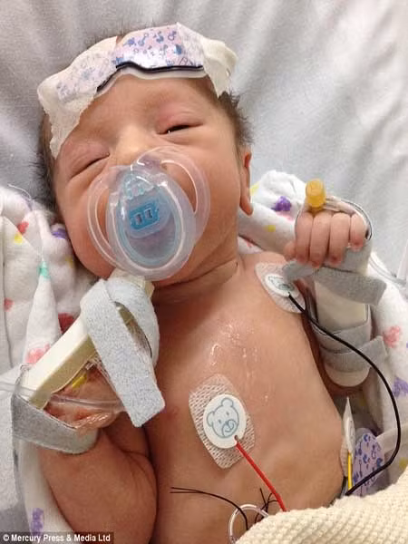 Bé Jack được sinh ra đầy đủ tháng. Song vì cân nặng quá thấp (gần 2 kg) nên em được đưa vào bệnh viện ngay sau khi sinh. Bác sỹ thông báo, em bị bệnh hiếm gặp, trên thế giới chỉ khoảng 3.500 đến 5.000 trẻ bị ảnh hưởng bởi bệnh này.