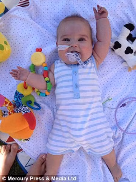 Jack đang được bố mẹ cho tham dự cuộc thi “em bé can đảm nhất Hartlepool”. Lễ trao giải cho em bé chiến thắng sẽ diễn ra vào ngày 30/4 tới. Cuộc thi này tổ chức ra nhằm gây quỹ cho trẻ em địa phương.