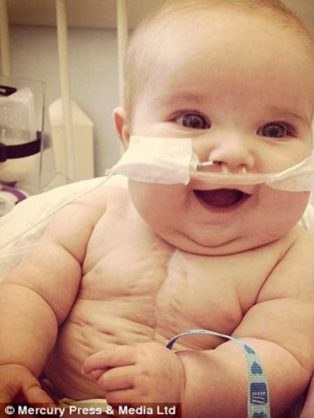 Jack chỉ có tim phải hoạt động bình thường. Em luôn phải trải qua phẫu thuật để các bác sỹ bơm máu vào động mạch chủ.