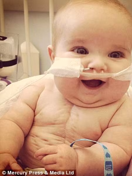 Jack chỉ có tim phải hoạt động bình thường. Em luôn phải trải qua phẫu thuật để các bác sỹ bơm máu vào động mạch chủ.