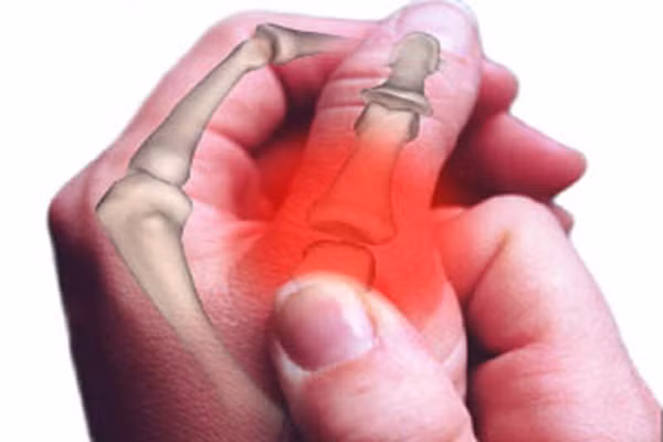 6. Viêm. Cơ thể luôn bảo vệ lợi ích tổng thể, và nó sẽ tập trung các loại virus và vi khuẩn lại một chỗ, tạo phản ứng đau đớn và sưng lên. Nếu như cứ dùng thuốc kháng sinh và chống viêm, vô tình sẽ đánh tan cụm vi khuẩn này và có một số con vẫn sống sót lạc vào các bộ phận khác dẫn đến giai đoạn thứ 7. Bạn nên tránh bước thứ 6 này bằng biện pháp tự nhiên như các loại thực phẩm chống viêm hoặc massage, các liệu pháp thể dục...