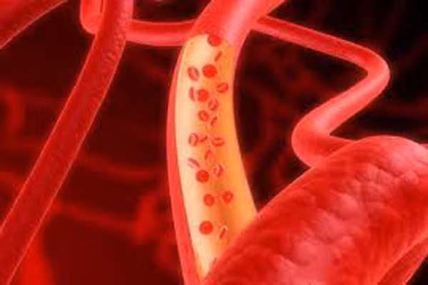 3. Có thể dùng nước dừa thay thế cho máu. Được quảng cáo như một thức uống vì nó có chứa điện giải và thành phần gần giống huyết tương trong máu người. Vì thế, nếu trong trường hợp cần máu khẩn cấp, có thể sử dụng nước dừa để truyền máu cho cơ thể. Ngoài ra, nước dừa còn được xem như một chất lỏng làm thông tĩnh mạch rất an toàn.