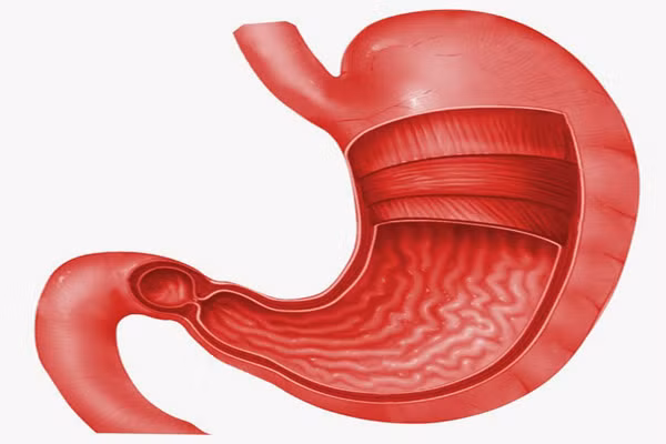 Axít. Dạ dày của chúng ta và một vài cơ quan khác chứa axit, để khi bất cứ vi trùng nào xâm nhập vào cơ thể qua đường thực phẩm hay đường khác, chúng sẽ giết chết các vi trùng, vi khuẩn đó. 