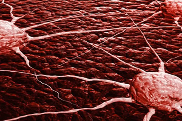 Giáo sư Peter McPherson - trưởng nhóm nghiên cứu thuộc Viện thần kinh Montreal McGill cùng đồng nghiệp đã phát hiện nhiều loại ung thư - đặc biệt là các loại ung thư biểu mô di căn đến não, có Rab13- một loại enzym thúc đẩy sự di chuyển của tế bào nhanh chóng.