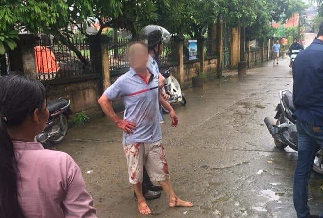 Tham sat gia dinh o Ha Noi: Anh chem em, 5 nguoi thuong vong