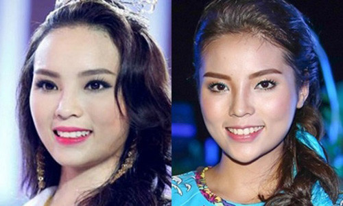 Chiếc cằm nhọn bất thường của Kỳ Duyên.