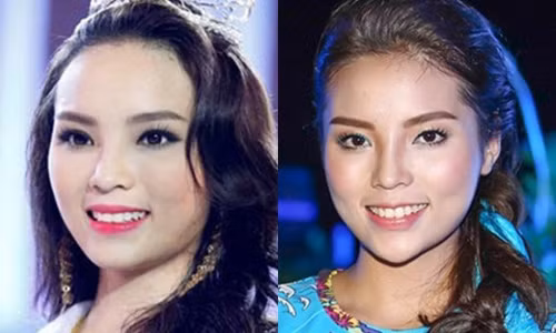 Chiếc cằm nhọn bất thường của Kỳ Duyên.