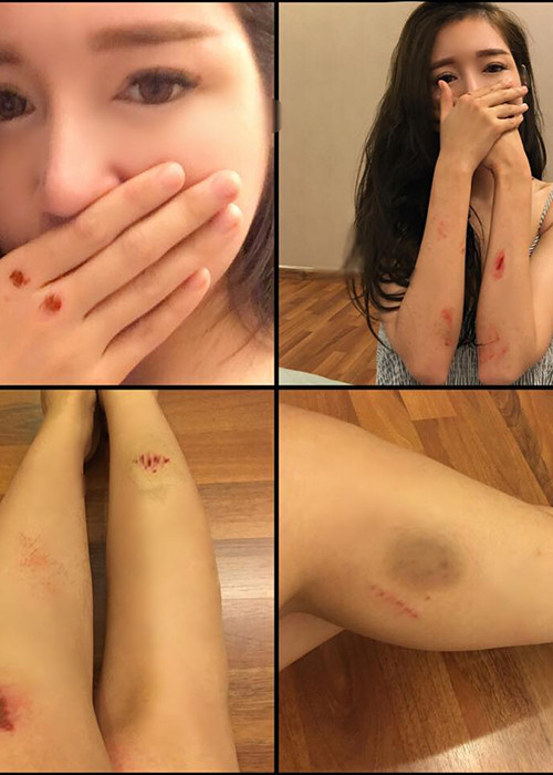 Được biết, sau khi sinh con trai thứ 2, Elly Trần đã trở lại làng giải trí. Gần đây, các fan của hot girl khá lo lắng khi cô chia sẻ hình ảnh bầm dập vì tự mình đóng cảnh hành động.