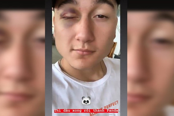 Van Lam khoe mat tham tren mang xa hoi