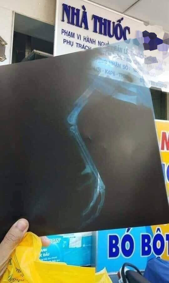 Vo keu than chong mang 