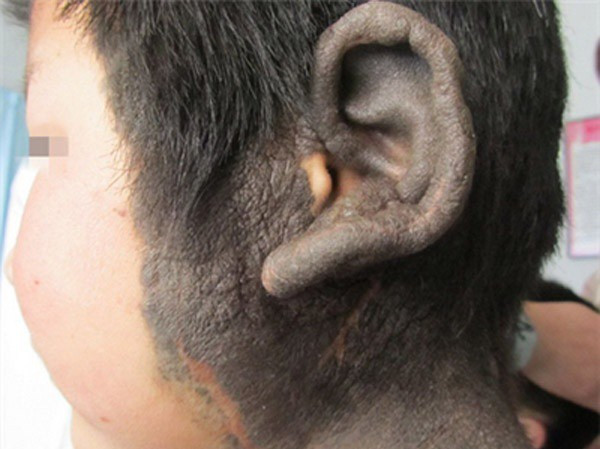 Can benh quai ac khien be trai 2 tuoi trong nhu nguoi vuon-Hinh-2