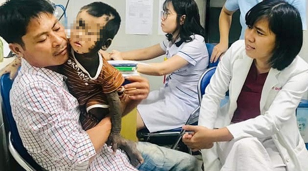 Can benh quai ac khien be trai 2 tuoi trong nhu nguoi vuon