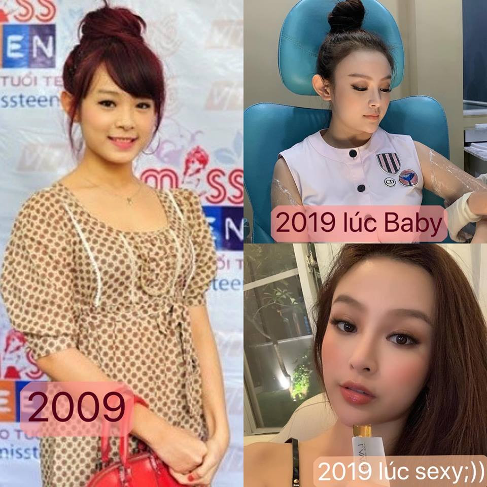 Huyen Baby tu lam phep so sanh nhan sac sau nhieu nam dao keo-Hinh-3