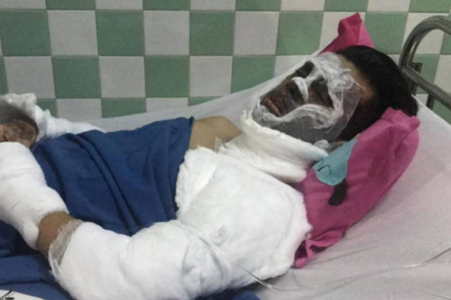 Tinh tiet soc vu doi nam nu Viet Kieu bi tat axit, cat gan chan