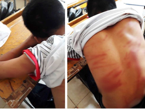 Tinh tiet moi vu nam sinh lop 8 bi bo danh da man phai nhap vien