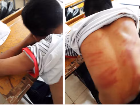 Tinh tiet moi vu nam sinh lop 8 bi bo danh da man phai nhap vien