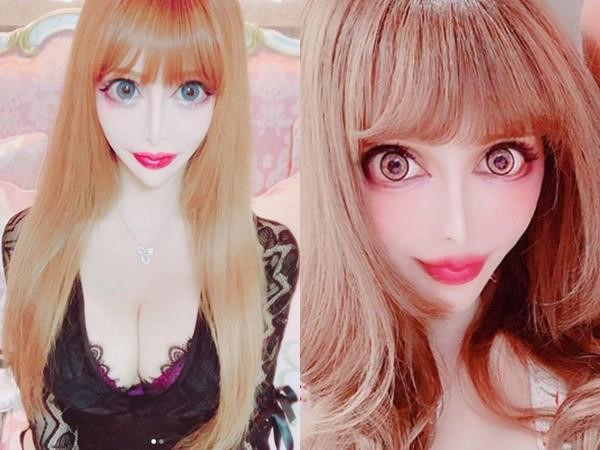 Nu nguoi mau bien thanh bup be song sau hang tram ca phau thuat