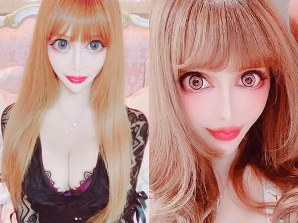 Nu nguoi mau bien thanh bup be song sau hang tram ca phau thuat