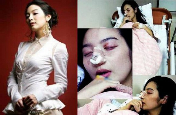 Lam Chi Linh bi bao hanh sau 4 thang ket hon?-Hinh-2