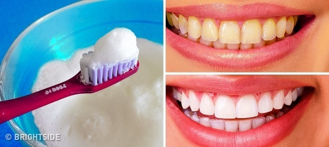 8. Kem đánh răng, muối, baking soda và nước chanh Nếu răng bạn có nhiều mảng bám và mức độ ố vàng nặng, bạn hãy thử trộn hỗn hợp kem đánh răng, muối, baking soda và nước chanh lại với nhau. Đánh răng với hỗn hợp này trong 4 - 5 phút rồi súc miệng sạch với nước để thấy công dụng làm trắng răng vượt trội ngay từ lần đầu tiên. Tuy nhiên, phương pháp này có một lưu ý đặc biệt là bạn chỉ được áp dụng tối đa 2 tháng/ 1 lần.