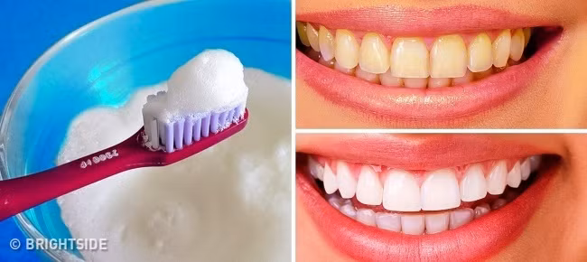 8. Kem đánh răng, muối, baking soda và nước chanh Nếu răng bạn có nhiều mảng bám và mức độ ố vàng nặng, bạn hãy thử trộn hỗn hợp kem đánh răng, muối, baking soda và nước chanh lại với nhau. Đánh răng với hỗn hợp này trong 4 - 5 phút rồi súc miệng sạch với nước để thấy công dụng làm trắng răng vượt trội ngay từ lần đầu tiên. Tuy nhiên, phương pháp này có một lưu ý đặc biệt là bạn chỉ được áp dụng tối đa 2 tháng/ 1 lần.