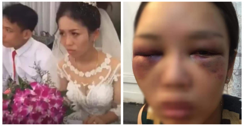 Ngay khi xuất hiện, clip nhanh chóng nhận về rất nhiều quan tâm. Đa phần thắc mắc về thái độ căng thẳng của cô dâu trong clip. Số khác lại bày tỏ không đồng tình về hành động của tân nương bởi đây là ngày vô cùng quan trọng trong cuộc đời của một người phụ nữ. 