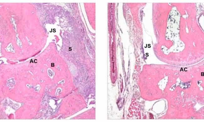 Canada phat trien phuong phap moi dieu tri cac benh tu mien