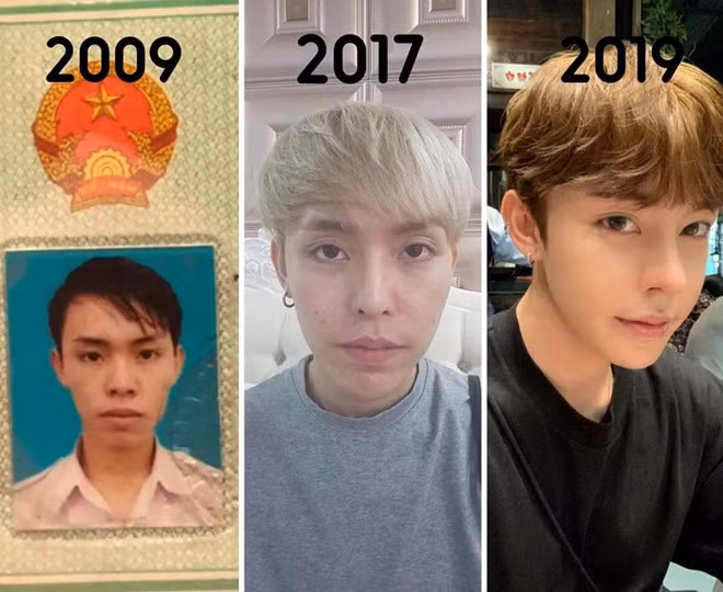 Chang trai Da Nang phau thuat tham my 9 lan trong 10 nam