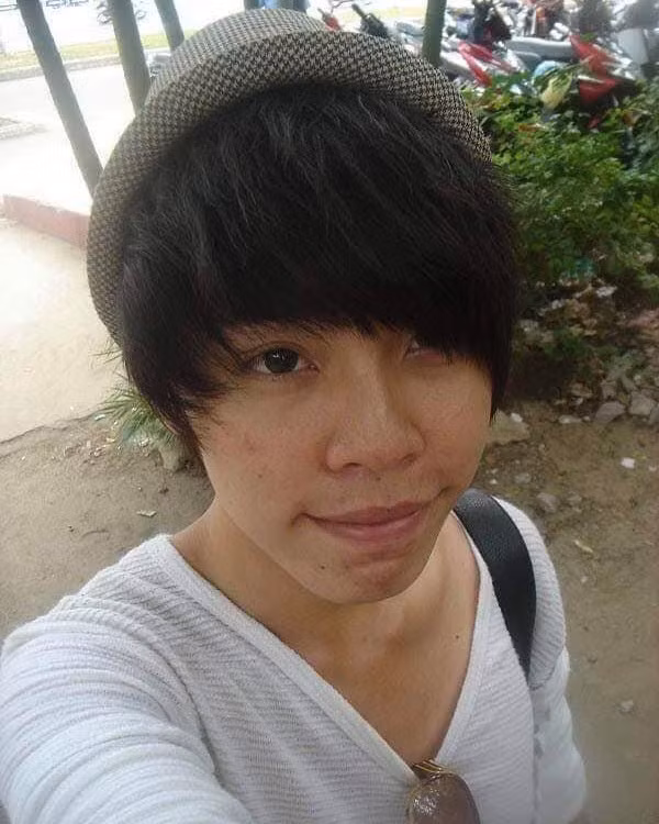 Chang trai Da Nang phau thuat tham my 9 lan trong 10 nam-Hinh-2