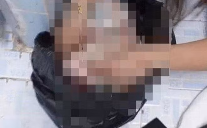 Phat hien thi the be so sinh boc trong chiec tui den o nha ve sinh