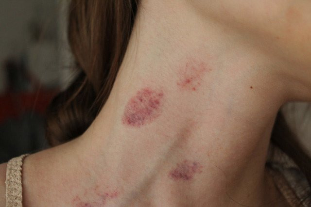 2 khu vuc cam ki duoc hon len keo doan menh