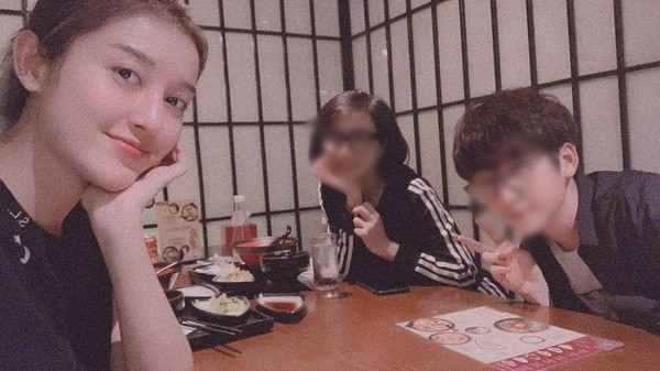 Huyen My phau thuat tham my hong, lien tuc de lo dang mui dieu hau?-Hinh-3