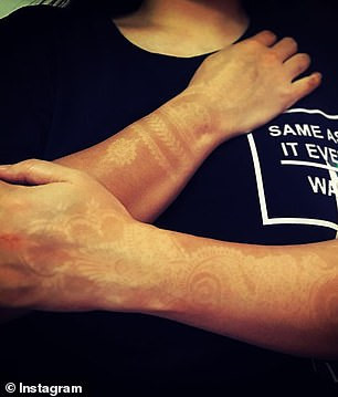 “Hinh xam chay nang“ - Canh bao xu huong lam dep nguy hiem-Hinh-3