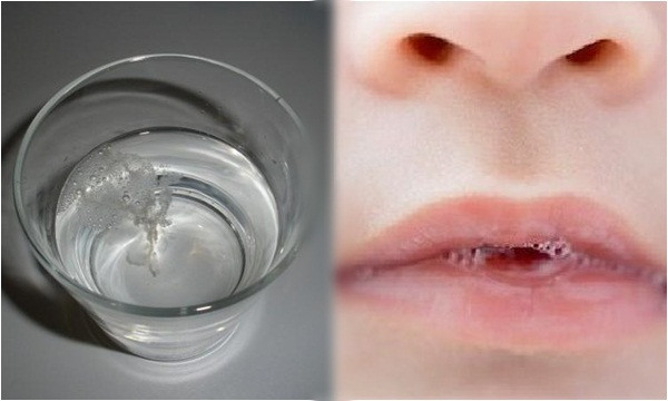 Dau hieu don gian nhan biet co the co bi nhiem nam Candida hay khong